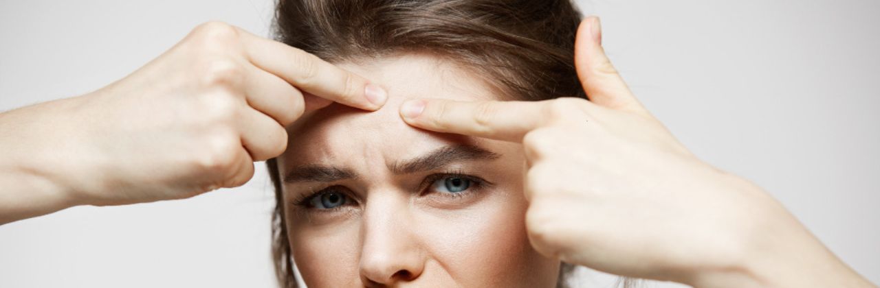 Blackheads: Causes, Prevention, and Effective Treatment