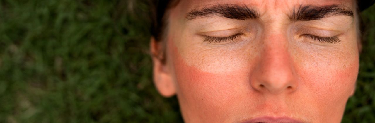 Brennende Haut im Gesicht: Ursachen und Lösungen